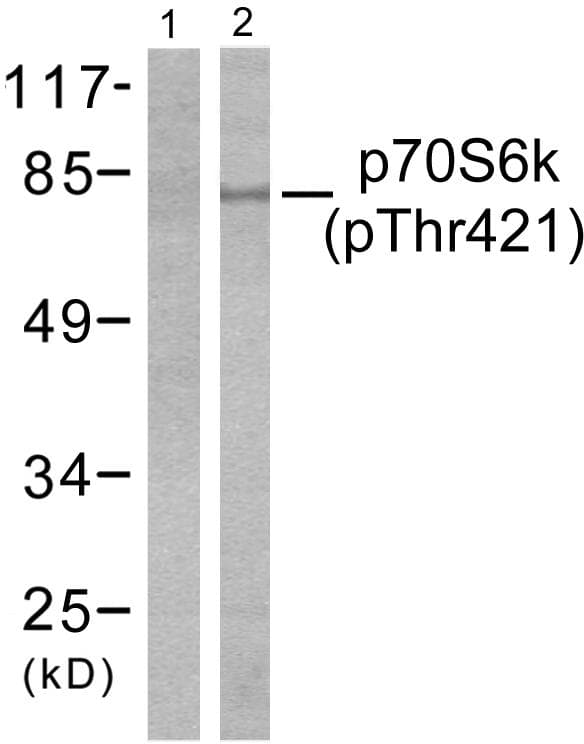 Polyclonal Rabbit anti-Human RPS6KB1 / P70S6K / S6K Antibody (phospho-Thr421, IHC, WB)