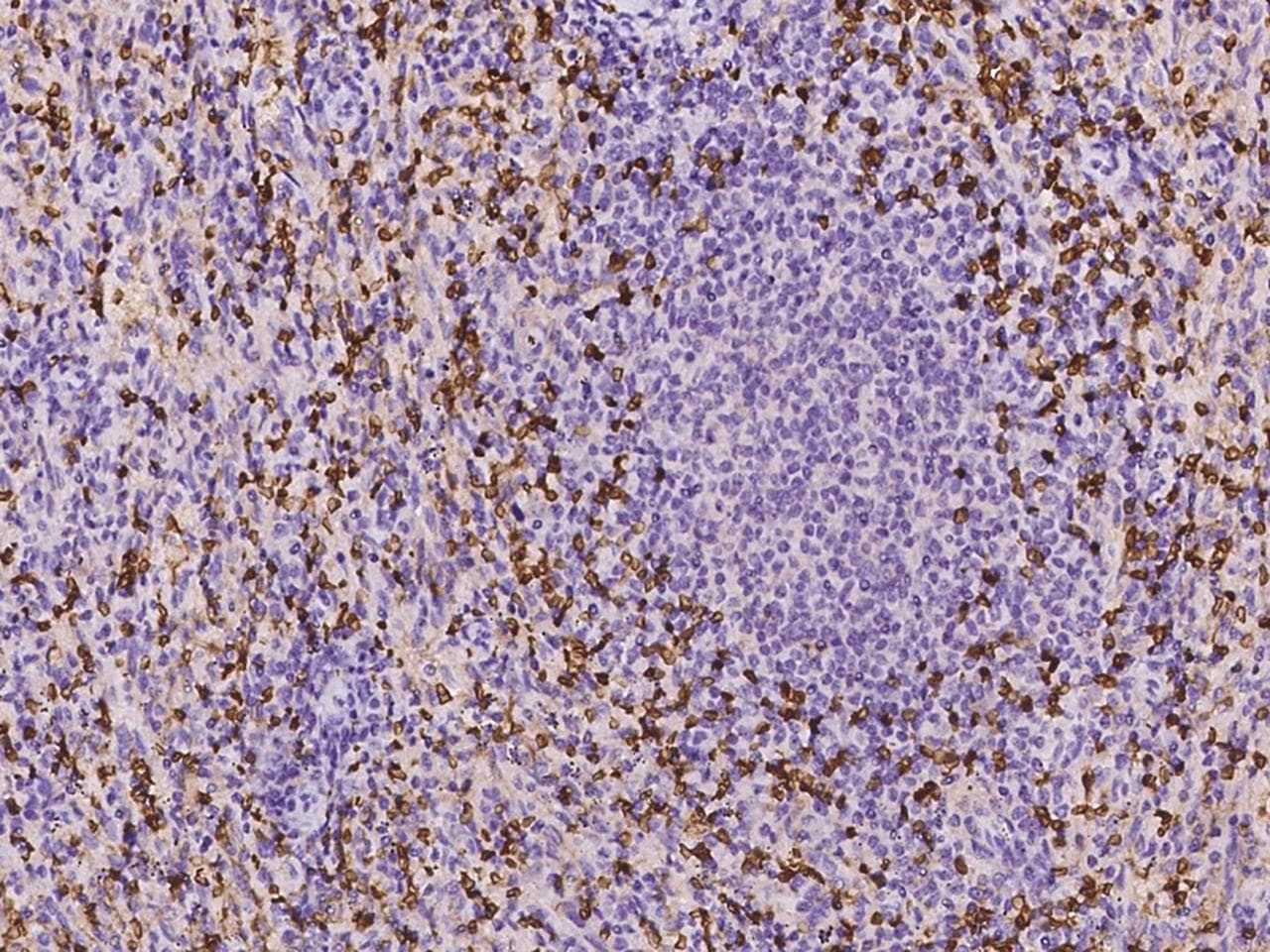 SLC40A1 / Ferroportin-1 Antibody