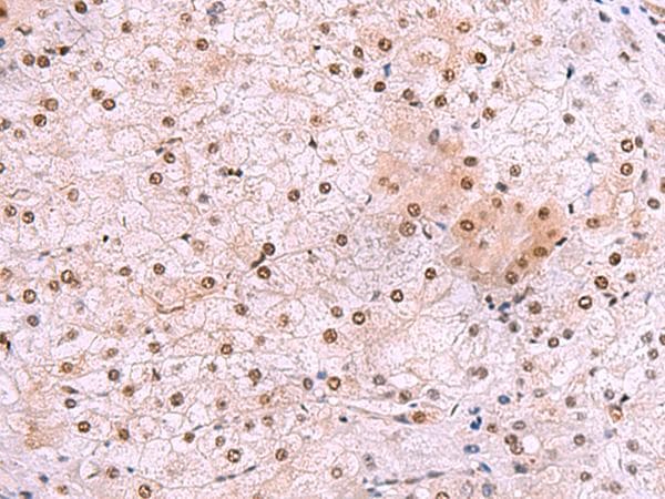 Polyclonal Rabbit anti-Human DDI2 Antibody (IHC)