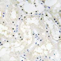 COUP-TFII / NR2F2 Antibody (N-Terminus)