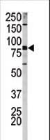 Polyclonal Rabbit anti-Human APP / Beta Amyloid Precursor Antibody (phospho-Ser730, WB)