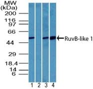 Polyclonal Rabbit anti-Human TIP49 / RUVBL1 Antibody (aa400-454, IHC, WB)