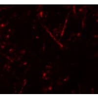 IHC-plus™ Vasohibin 1 / VASH1 Antibody