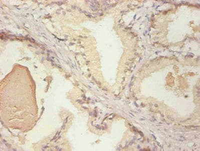 IHC-plus™ LCN2 / Lipocalin 2 / NGAL Antibody
