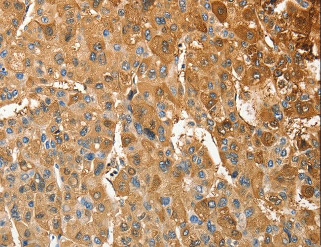 ANXA9 Antibody