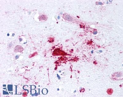 IHC-plus™ Polyclonal Rabbit anti-Human BACE1 / BACE Antibody (N-Terminus, IHC)