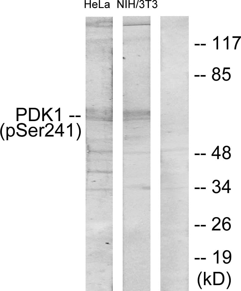 PDPK1 / PDK1 Antibody (phospho-Ser241)
