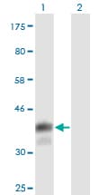 Monoclonal Mouse anti-Human CD5 Antibody (clone 2F7, WB)
