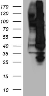 NFKB2 Antibody
