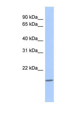 DCAL1 / CLECL1 Antibody (N-Terminus, FITC)