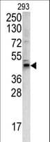 IHC-plus™ Polyclonal Rabbit anti-Human WNT4 Antibody (aa242-269, IHC, WB)