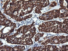 ACAA2 Antibody (clone OTI2H2)