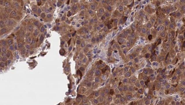 GNAO1 Antibody