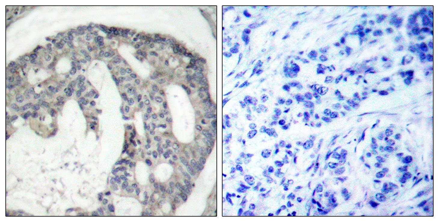 NOS3 / eNOS Antibody (phospho-Ser1177)
