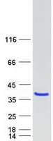 Human TLDC2 / C20orf118 Protein (Recombinant Myc-DDK (Flag))