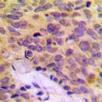 MRPL16 Antibody (C-Terminus)