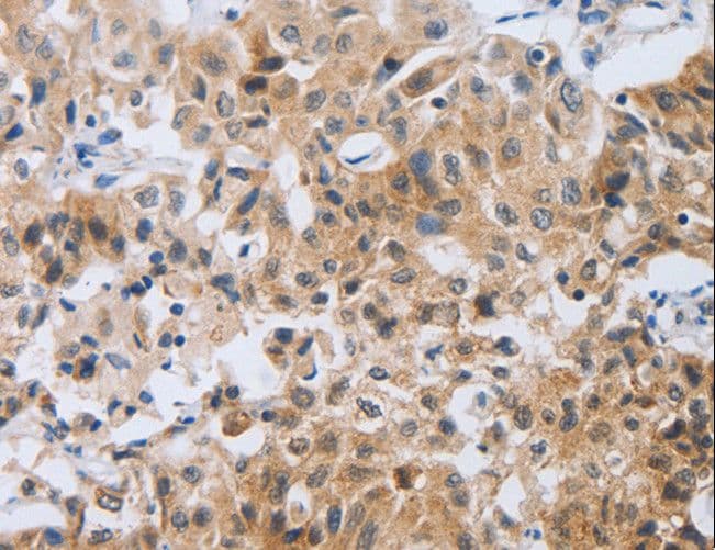 Polyclonal Rabbit anti-Human NEB / Nebulin Antibody (IHC)
