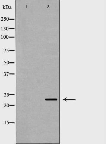 FXN / Frataxin Antibody