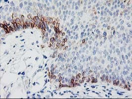 TBC1D21 Antibody (clone OTI1C7)