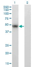 PAX8 Antibody (clone 2F1)