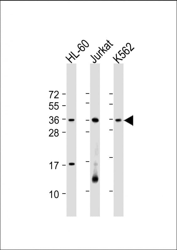 RSPO1 / RSPO Antibody (aa206-240)