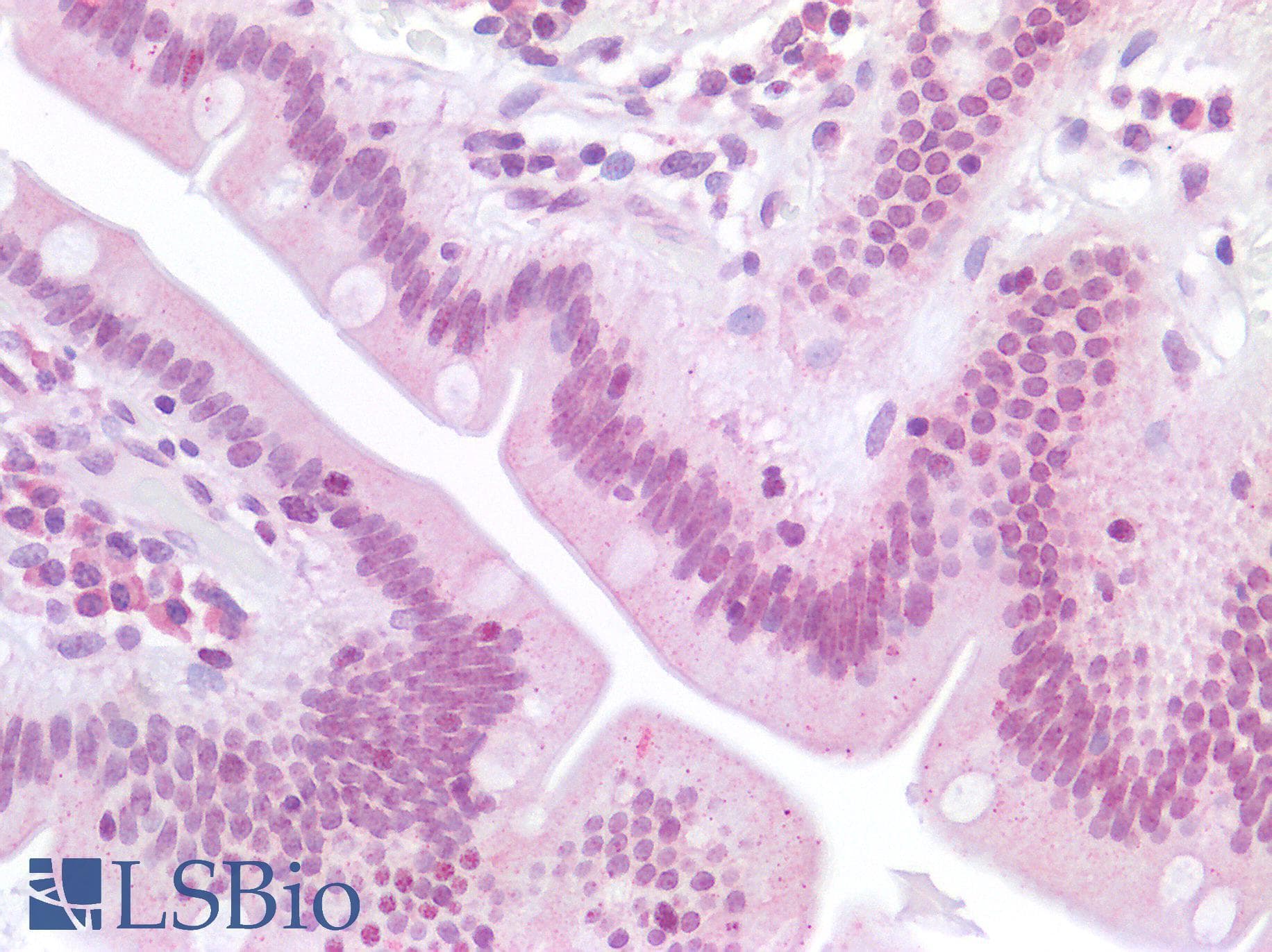 RAB8A / RAB8 Antibody (C-Terminus)