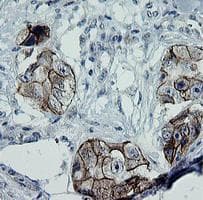 ERBB2 / HER2 Antibody (aa676-1255, clone OTI1A12, Carrier-free)