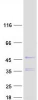 Human HEMK1 Protein (Recombinant Myc-DDK (Flag))