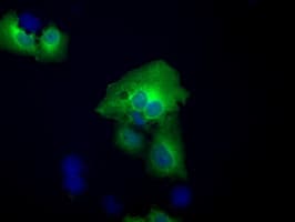ACAT2 Antibody (clone OTI5F7)