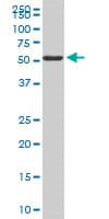 FGL2 Antibody (clone 6D9)