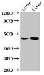 CHKB / CHKL Antibody