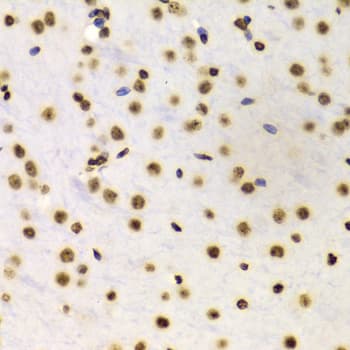 Polyclonal Rabbit anti-Human Histone H3 Antibody (Di-Methyl-Lys4, IHC, IF, WB)