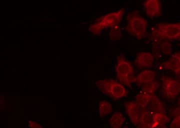 PVRL4 / Nectin 4 Antibody