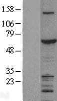 ZGPAT Protein (Over-Expression Lysate Myc-DDK (Flag))
