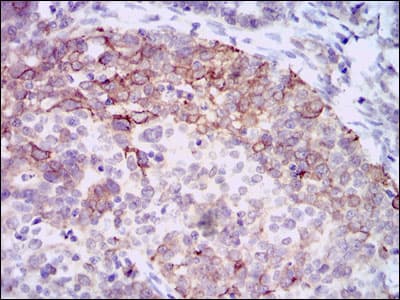 HAS3 Antibody (aa312-364, clone 3C9)