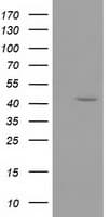 IHC-plus™ GMDS / GMD Antibody (clone 2A1)