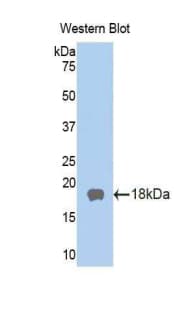 BLIMP1 / PRDM1 Antibody (aa83-203)