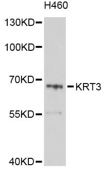 Polyclonal Rabbit anti-Human KRT3 / CK3 / Cytokeratin 3 Antibody (WB)