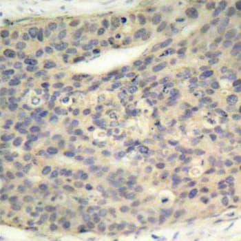 LIMK1 / LIMK Antibody (phospho-Thr508)