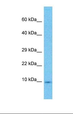 Polyclonal Rabbit anti-Human HMGN3 Antibody (aa21-70, WB)