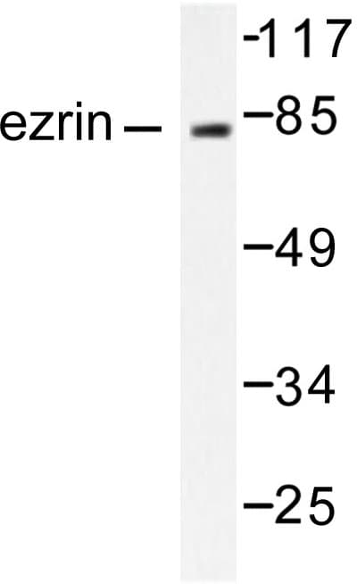 Polyclonal Rabbit anti-Human EZR / Ezrin Antibody (Ser539, IHC, WB)