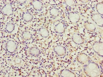 MRPL49 Antibody