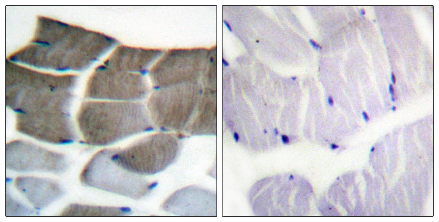 Acetyl-CoA Carboxylase / ACC Antibody (p80)
