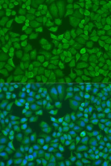 Polyclonal Rabbit anti-Human CRD-BP / ZBP1 / IGF2BP1 Antibody (IHC, IF, WB)