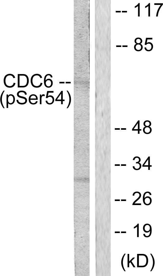 CDC6 Antibody (phospho-Ser54)