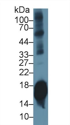 SNCA / Alpha-Synuclein Antibody (aa23-140, APC)