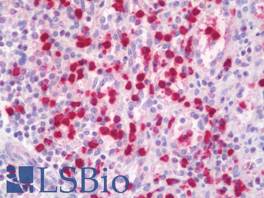 LCN2 / Lipocalin 2 / NGAL Antibody (FITC)