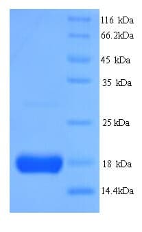 Human IL2 Protein (Recombinant His)