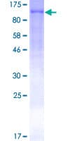 Human GPBB / PYGB Protein (Recombinant GST)