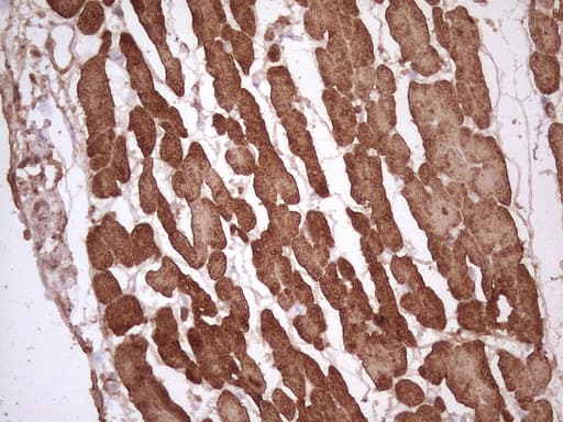 Monoclonal Mouse anti-Human TNNI3 / Cardiac Troponin I Antibody (clone OTI4C1, aa1-210, IHC, WB)